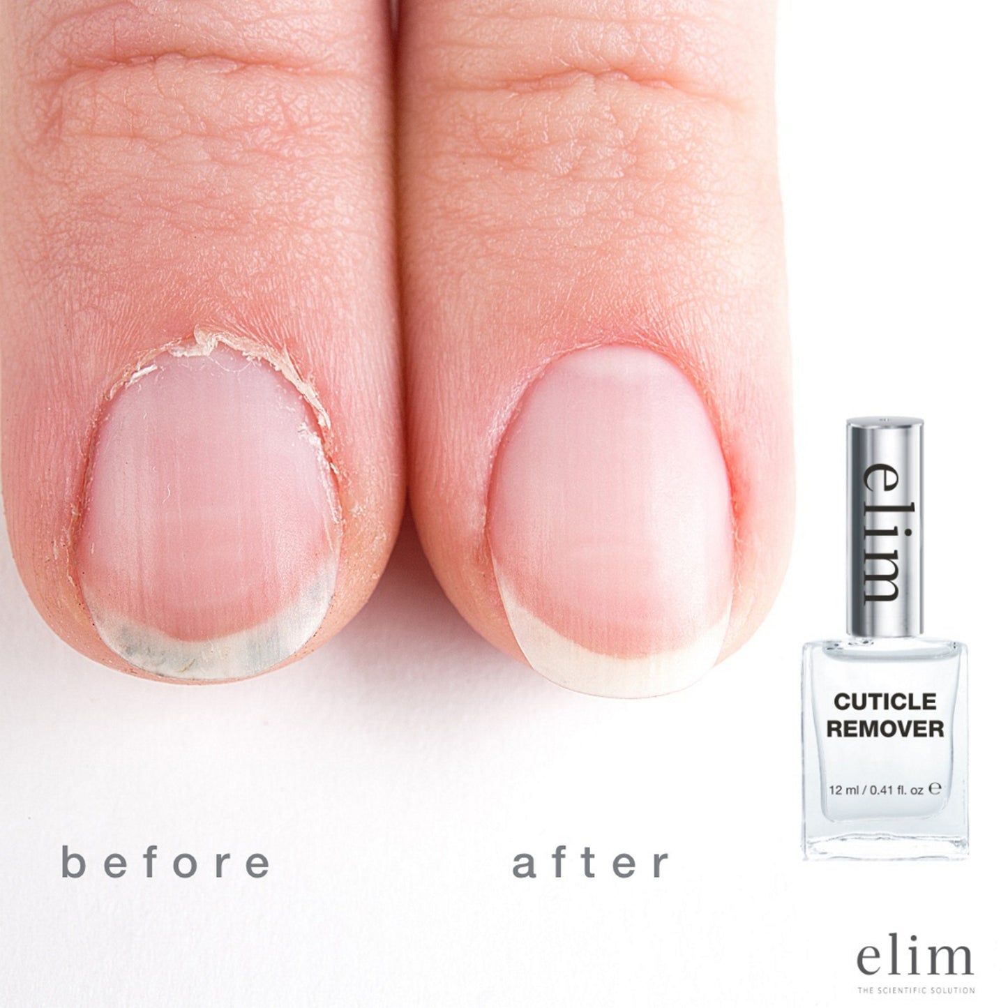 Elim Cuticle Remover