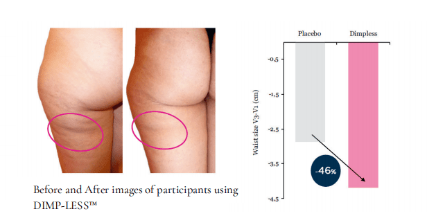 DIMP-LESS™ Clinically Proven Cellulite Management