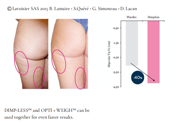 DIMP-LESS™ Clinically Proven Cellulite Management